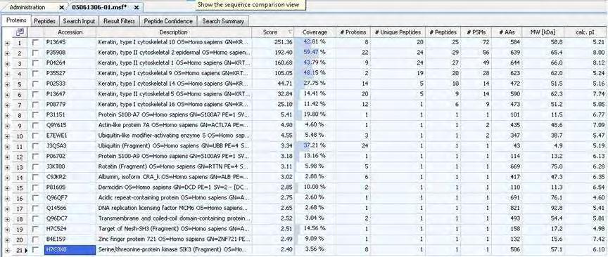 55 Anti-PARN74-IP RNase A