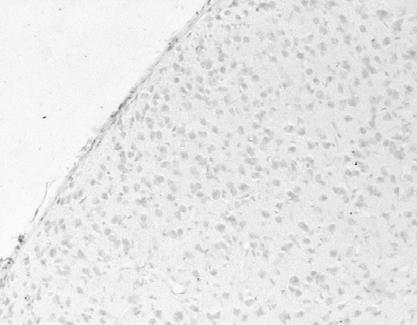 σηµαντική αύξηση της πυκνότητας των TUNEL+ κυττάρων στον ετεροπλάγιο dlgn τη ΜΒ1 συγκριτικά µε τους µάρτυρες (Εικόνα 9). Τη ΜΒ7 παρατηρήθηκε πολύ µικρός αριθµός TUNEL+ κυττάρων.