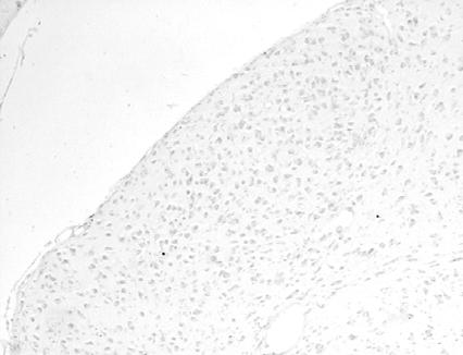 Αποτελέσµατα κυττάρων τη ΜΒ1 ήταν αντιστρόφως ανάλογη της ηλικίας στην οποία πραγµατοποιήθηκε η βλάβη.