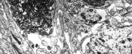 Ν Α Β ΝΓ Γ Ν Εικόνα 15: Μικροηλεκτρονιογραφίες στις οποίες φαίνονται κύτταρα µε