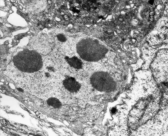 ίπλα στα κύτταρα αυτά φαίνεται ένας «ζωντανός» νευρώνας (Ν). Ράβδος = 1,15µm.