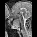 Απεικόνιση δυναμικών MRI: 3 πλαίσια από μία