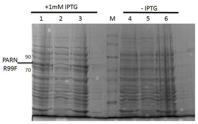 Εικόνα 21δ. Προφίλ έκφρασης PARN R99F. Μ: Marker, 1,4: input με και χωρίς IPTG αντίστοιχα. 2,5: υπερκείμενο με IPTG και χωρίς αντίστοιχα, 3,6: ίζημα με και χωρίς IPTG αντίστοιχα.