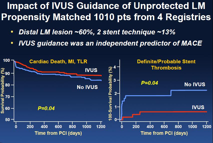 IVUS for LM PCI De la