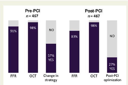 ILUMIEN 1 418 pts with 467 lesions, OCT and FFR Physician decision-making was affected by OCT imaging prior to PCI in 57% and post-pci in