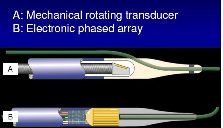 Intravascular