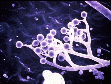 Περονόσπορος Καπνού (12) Peronospora tabacina. Προσβάλλει επίσης πιπεριά, μελιτζάνα και άλλα είδη Nicotiana.