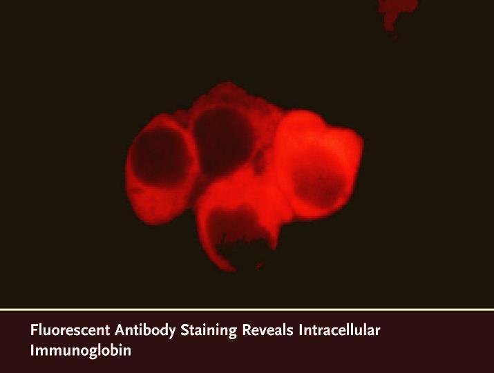 Употреба на антителата во научни и клиничкодијагностички цели Одредување (во крв) на нивото на: Хормони Антитела