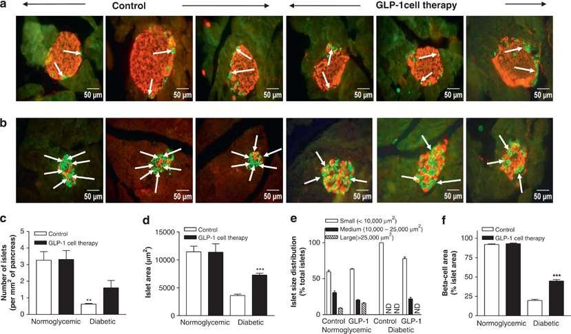 Αύξηση της μάζας των β-κυττάρων μετά από