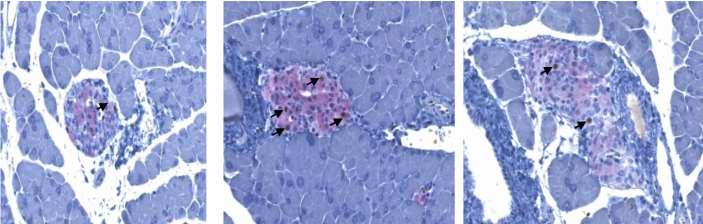 β-κυττάρων Am J Physiol