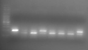 Από τα 107 δείγματα με επιτυχημένη PCR, επιτυχή πέψη είχαν τα 107 δείγματα. Από αυτά τα 53 (49.5%) ήταν GG, τα 49 (45.7%) ήταν GC και 5 (0.05%) ήταν CC.