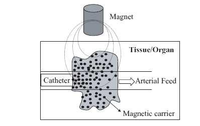 Σχήµα 2.2: Σχηµατική αναπαράσταση ενός µαγνητικά µεταφερόµενου φαρµάκου στην επιθυµητή περιοχή.