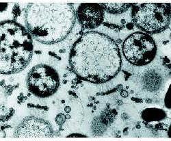 TEM δείχνει την ποικιλία μικροοργανισμών στο βιοφιλμ