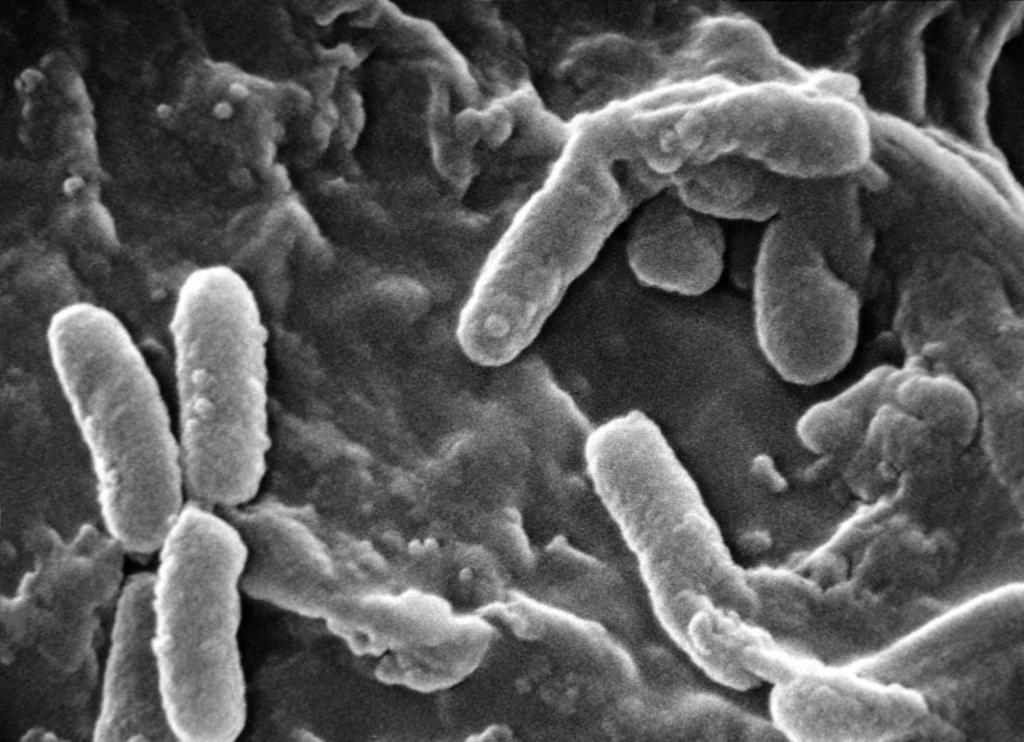 Gram αρνητικά βακτήρια σε σχήμα ράβδου, που δεν