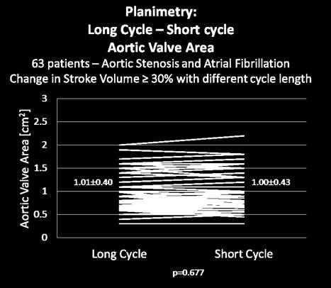 Impact of variations in SV on AVA in patients with AoS and AF