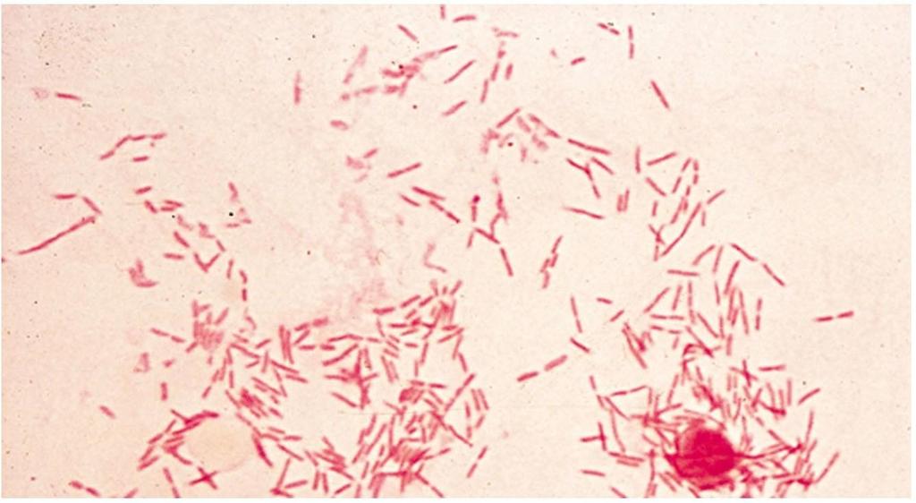 Escherichia