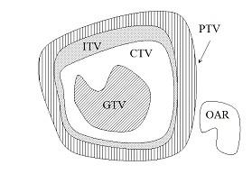 Gross Tumor Volume (GTV) είναι η προφανής ορατή κακοήθεια ή/και η ορατή προέκταση και τοποθεσία της κλινικά αποδεδιγμένης κακοήθειας.