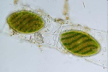 šūnu protoplasti Spirogiru konjugācija