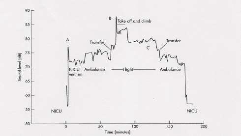 Σχήμα 1: Μεταβολές της έκθεσης των ασθενών στο θόρυβο κατά τη διάρκεια επίγειων και εναέριων διακομιδών. 2.5.