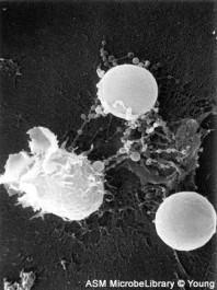 Celulele infectate prezintă pe suprafaţa sa peptide antigenice asociate cu moleculele CMH I, fiind recunoscute de către TCR şi CD8 de pe limf Tc.