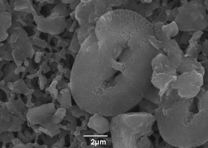 1α 1β 1γ 2α 2β 2γ ΠΙΝΑΚΑΣ III: 1: Helicosphaera carteri (Wallich)