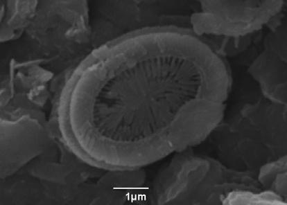 1α 1β 2α 2β 3α 3β ΠΙΝΑΚΑΣ ΙV 1: Syracosphaera pulchra (Lohmann) α: εικόνα από