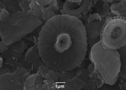 (Weber-van Bosse) Gaarder α: εικόνα πλακόλιθου από ηλεκτρονικό μικροσκόπιο, SL 152,