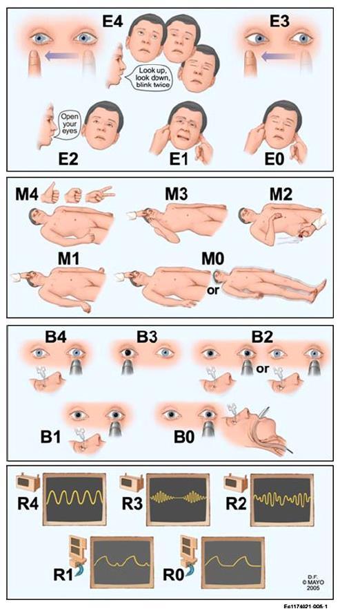 Full Outline of UnResponsiveness score 38% των ασθενών σε