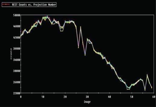 Lung/Herat ratio θαη γηα απεηθφληζε ηεο δεμηάο θνηιίαο. (Θα αθνινπζήζεη παξαθάησ εθηελή αλαθνξά ζηα ζπγθεθξηκέλα επξήκαηα).
