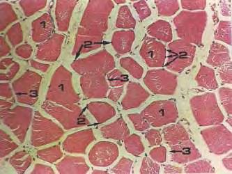 Εικ.4 Εικ.5 Εικόνα 4. Γραμμωτός μυϊκός ιστός. 1.γραμμωτή μυϊκή ίνα σε εγκάρσια διατομή, 2.πυρήνες γραμμωτών μυϊκών ινών, 3.ενδομύιο. Χρώση Αιματοξυλίνη-Εωσίνη x 200 Εικόνα 5. Λείος μυϊκός ιστός. 1.λεία μυϊκή ίνα σε εγκάρσια διατομή, 2.