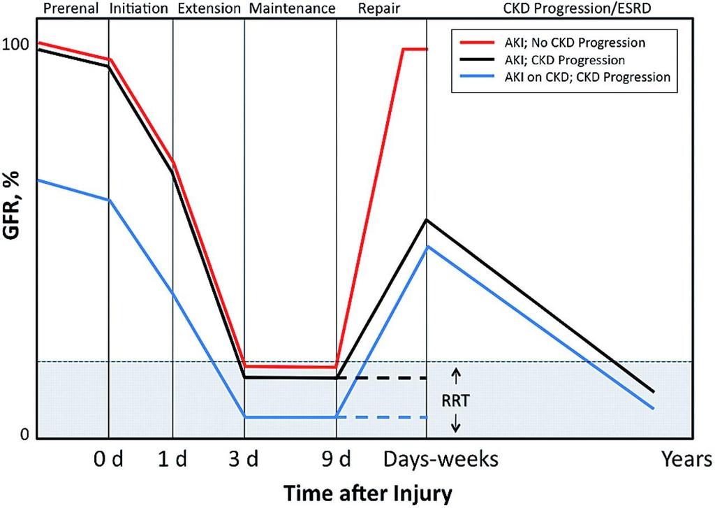 Natural history of acute kidney injury (AKI).