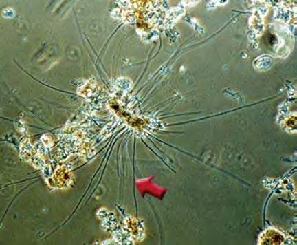 Εικόνα 2 : Νηματοειδή Βακτήρια(Ο.Ε.Ε.Λ.Σ. 2006) 2.1.