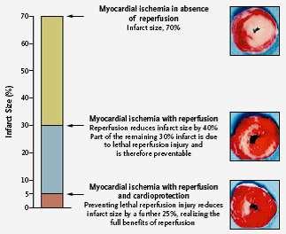 Reperfusion Injury Reperfusion injury is an entity separate