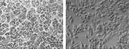 Εικόνα 34: Μορφολογική σύγκριση (A) ανθρώπινων ηπατικών κυττάρων με την κυτταρική σειρά ηπατoκαρκινώματος HepG2 (B). 4.