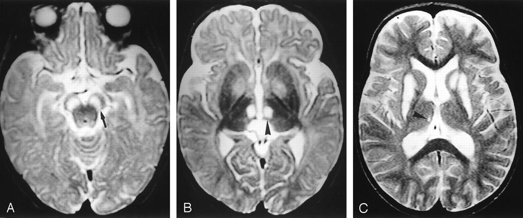Slikovna diagnos4ka MRI, MRS Vir: Internet.