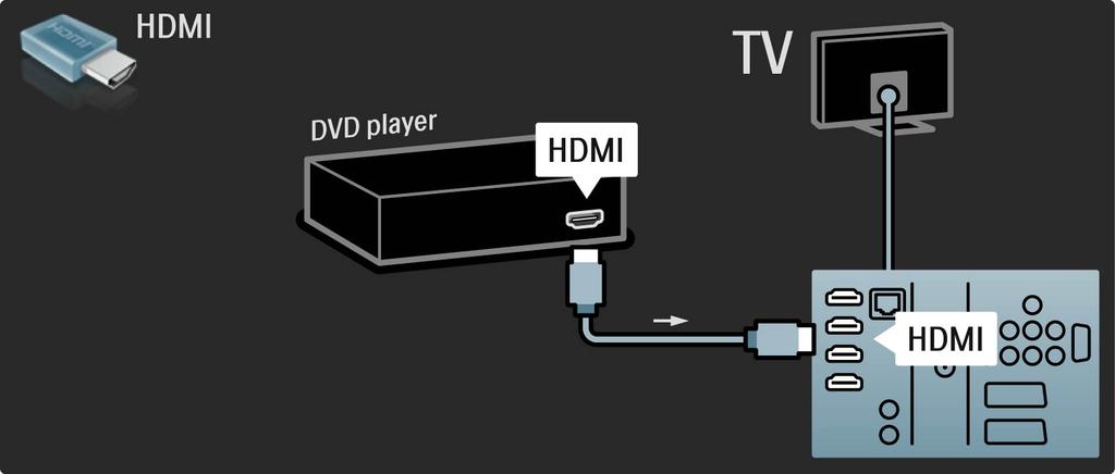 5.3.1 DVD-mängija Kasutage DVD-mängija ühendamiseks