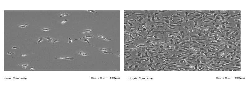 Εικόνα : Κύτταρα Ea.hy 926 σε οπτικό μικροσκόπιο 5.