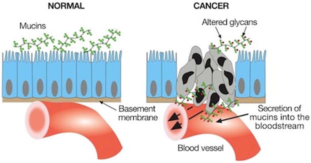 tumorjev. Nenormalni mucini možni označevalci (biomarkerji) raka.