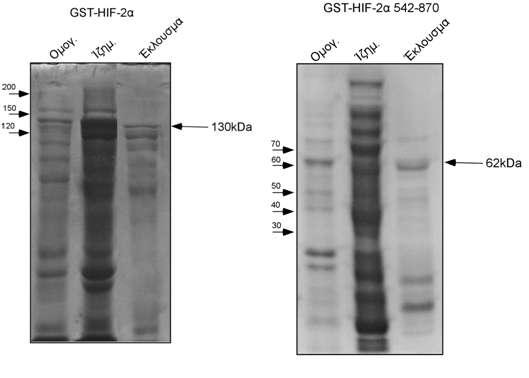 Εικόνα 17: Απομόνωση πλήρους μεγέθους HIF-2α καθώς και του τμήματος HIF-2α 542-870 σε σύντηξη με GST.