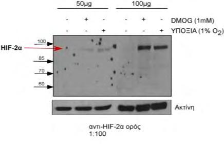 Β Εικόνα 22: Ανίχνευση του ενδογενή HIF-2α με το αντί-hif-2α ορό σε κύτταρα Huh7 με τη μέθοδο της ανοσοαποτύπωσης. Ανοσοαποτύπωση με αντισώματα έναντι στον HIF-2α με ορό αντί-hif-2α Α. 1: 50 Β.