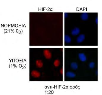 Εικόνα 23: Ανίχνευση του ενδογενή HIF-2α με το αντι-hif-2α ορό σε κύτταρα Huh7 με τη μέθοδο του ανοσοφθορισμού.