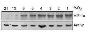 Για να διερευνηθεί εάν αυτό ισχύει και στα κύτταρα Huh7, τα κύτταρα καλλιεργήθηκαν σε συγκεντρώσεις οξυγόνου από 1 έως 10% για 2 ώρες και μελετήθηκε η έκφραση του HIF-2α και του HIF-1α.
