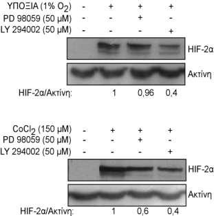 του αναστολέα LY294002, η επαγωγή του και από την υποξία και από το CoCl 2 μειώθηκε σημαντικά (Εικόνα 30).