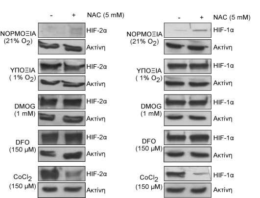 συνθήκες υποξίας ή παρουσία δεσφερριοξαμίνης ή DMOG δεν επηρέασε την έκφραση του HIF-2α, ενώ η ίδια συγκέντρωση NAC παρουσία CoCl 2 οδήγησε σε μείωση της επαγωγής του HIF-2α από το CoCl 2 (Εικόνα 31).