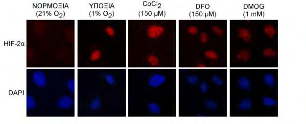 καλλιεργήθηκαν σε νορμοξία ή υποξία ή παρουσία CoCl 2, ή DFO ή DMOG για 4 ώρες. Ακολούθησε μονιμοποίηση των κυττάρων σε καλυπτρίδες και μικροσκοπία ανοσοφθορισμού για την ανίχνευση του HIF-2α.
