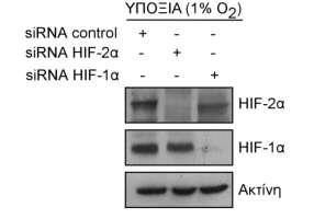 Εικόνα 35: Επίδραση της αποσιώπησης της έκφρασης του HIF-2α και του HIF-1α με sirna στην έκφραση του HIF-2α και του HIF-1α σε κύτταρα Huh7.