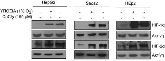 3.2.4. ΜΕΛΕΤΗ ΤΗΣ ΕΠΑΓΩΓΗΣ ΤΟΥ HIF-2α ΑΠΟ ΤΗΝ ΥΠΟΞΙΑ ΚΑΙ ΤΟ ΧΛΩΡΙΟΥΧΟ ΚΟΒΑΛΤΙΟ ΣΕ ΑΛΛΕΣ ΚΥΤΤΑΡΙΚΕΣ ΣΕΙΡΕΣ. 3.2.4.1.