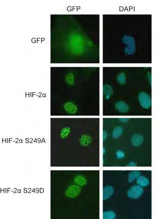 Α Β Εικόνα 54: Έλεγχος της έκφρασης και του υποκυτταρικού εντοπισμού των HIF-2α-S249Α και HIF- 2α-S249D. Α.