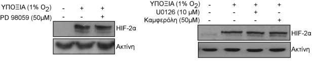 Εικόνα 56: Επίδραση των αναστολέων του μονοπατιού των ERK1/2 στην έκφραση του HIF-2α σε κύτταρα Huh7.