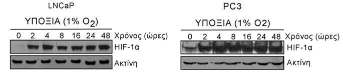 υποδεικνύει τον κυρίαρχο ρόλο του HIF-1α σε κύτταρα LNCaP και PC3 και για αυτό η μελέτη επικεντρώθηκε σε αυτόν.